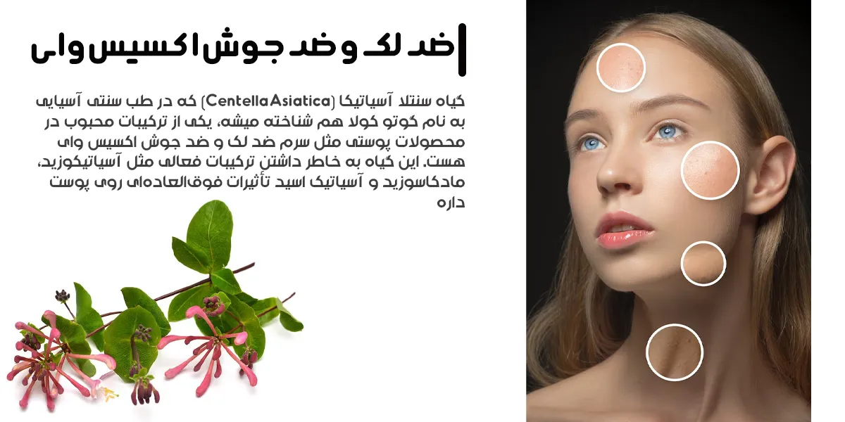 ضد لک اکسیس وای | ضد جوش اکسیس وای | فروشگاه سارای