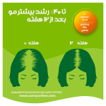 مکمل پریورین |ضد ریزش و تقویت مو | فروشگاه سارای انلاین